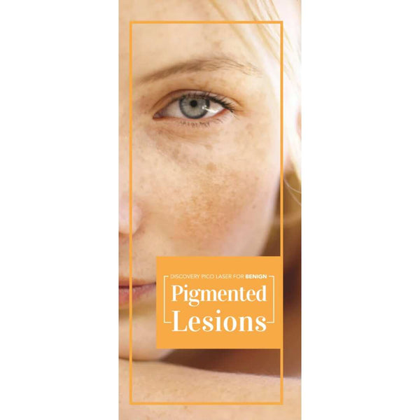 Benign Pigmented Lesions Patient Brochure